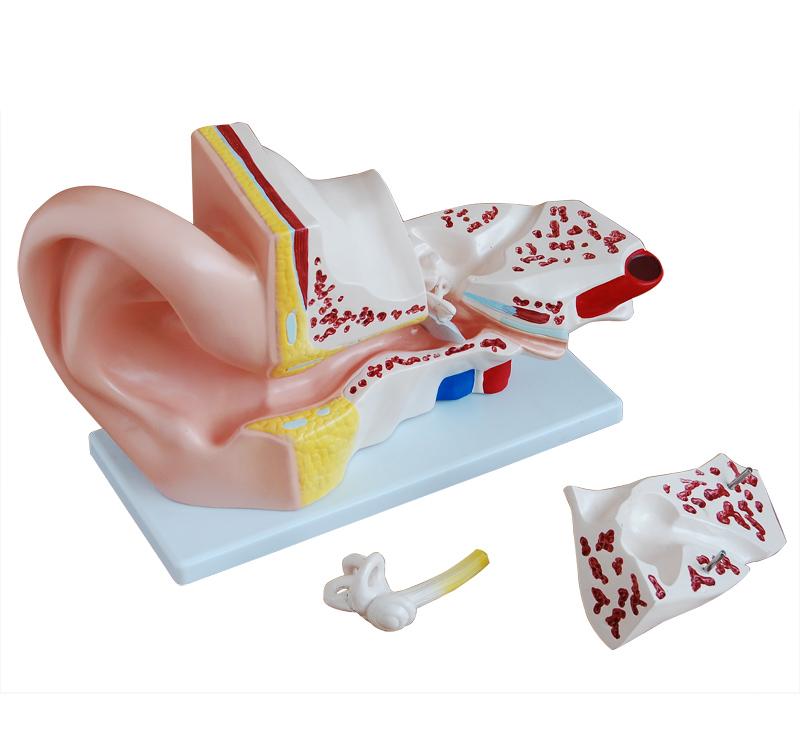 XC-303A Giant Ear Model