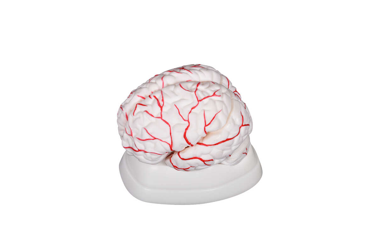 XC-308 Brain with Arteries