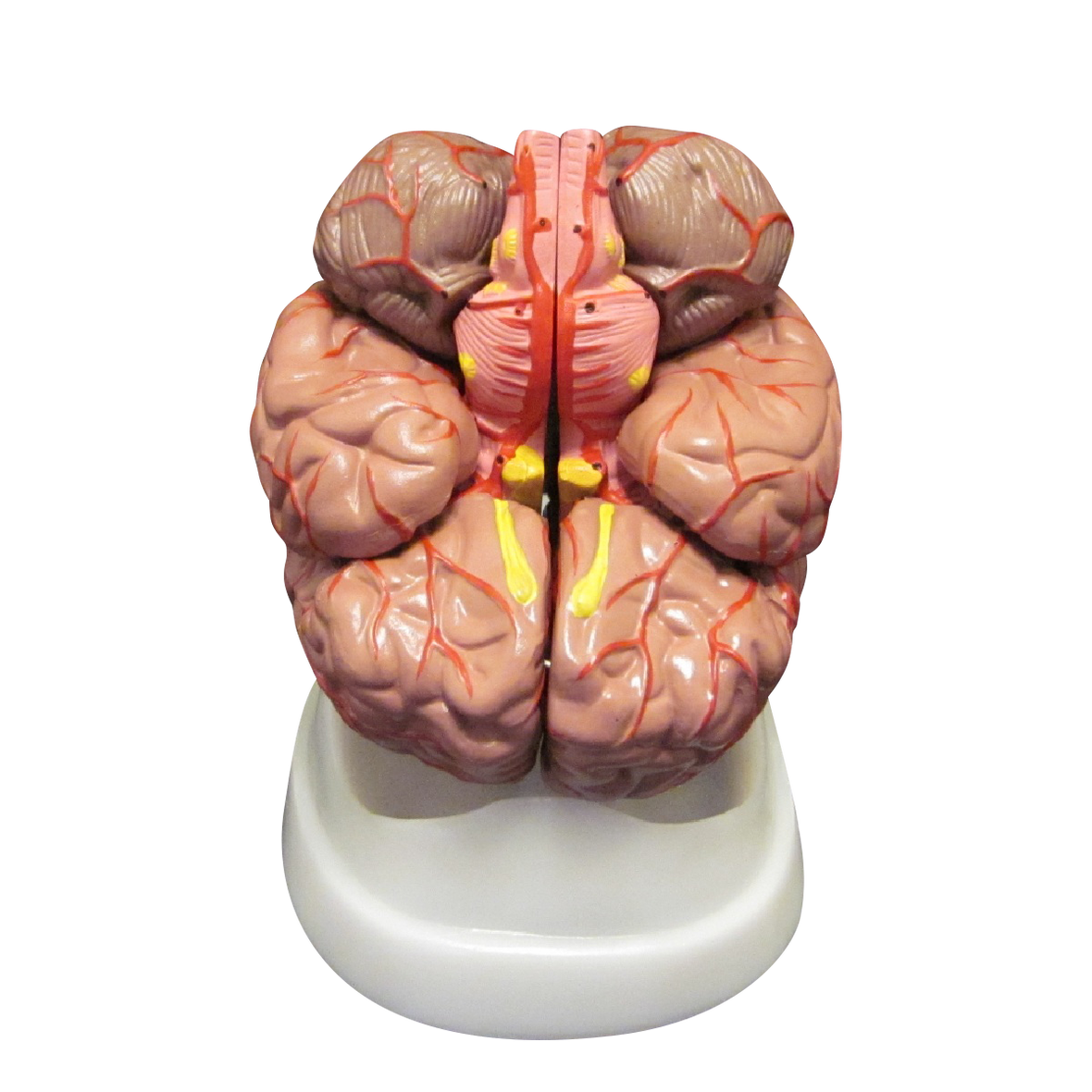 XC-308A Brain with Arteries (Colored)