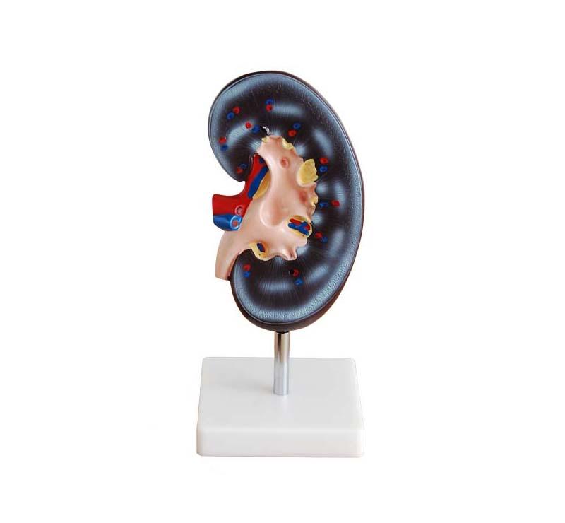 XC-310-1 Kidney Model (1 Part)