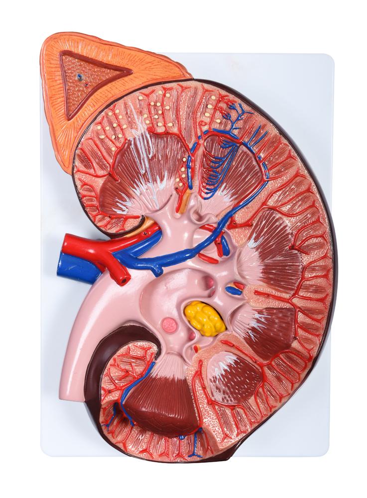 XC-310-4 Enlarged Kidney Model 1 Part