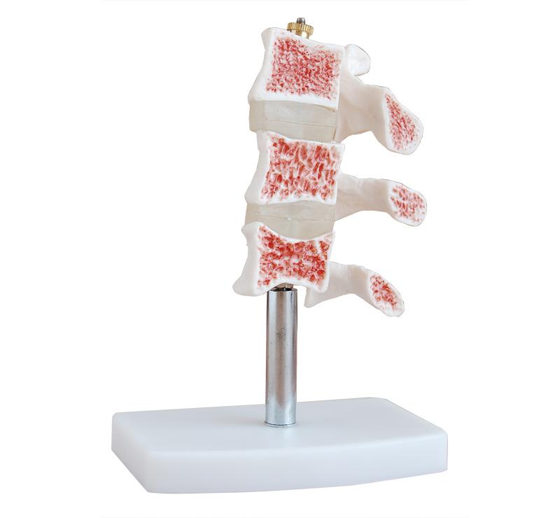  XC-100 Skeleton Series  >  Spine Models  >  XC-13