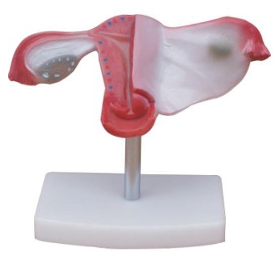 XC-436 Natural Uterus Model