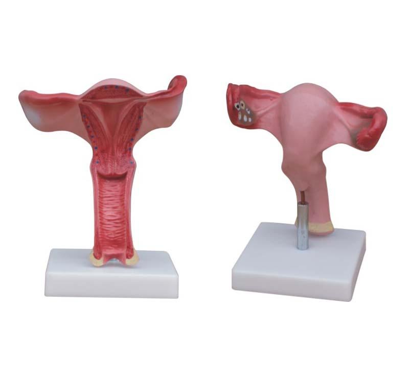 XC-436A Magnified Uterus Model